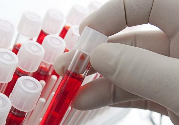 Bluttest nach Alkoholkonsum